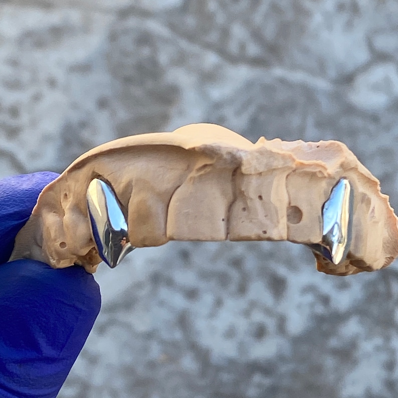 Puede incluir: Primer plano de un molde dental con dos tapas de dientes de color plateado. El molde es de color marr&oacute;n claro y las tapas son brillantes.