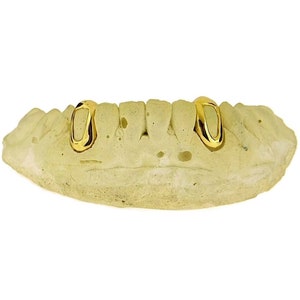 May include: Gold tooth grill with two front teeth, displayed on a plaster mold.