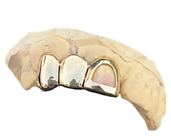 Solid 10K/14K Gold Custom Grillz, Perm Cut, Three Teeth, One Open Face