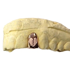 Solid 10K Rose Gold or 14K Rose Gold Single Cap Broken Heart Laser Engraved Real Custom Fit Grillz Handmade Any One Tooth