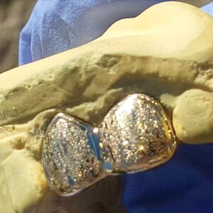 May include: A gold tooth grill with a diamond-like finish. The grill is shaped like a bow tie and is designed to fit over a single tooth.