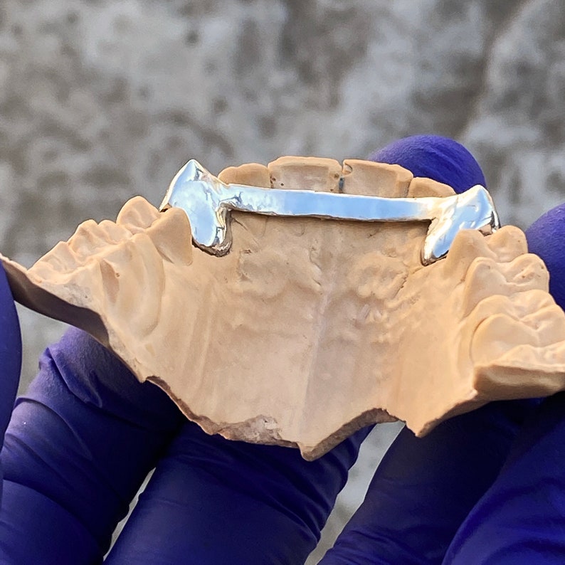 Puede incluir: Una rejilla dental de plata, mostrada en un modelo dental. La rejilla est&aacute; hecha de una sola pieza de metal y tiene un acabado liso y pulido.