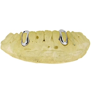 May include: Two silver-colored dental caps, also known as grills, are shown on a yellow dental mold. The caps are oval-shaped and have a smooth, polished finish.