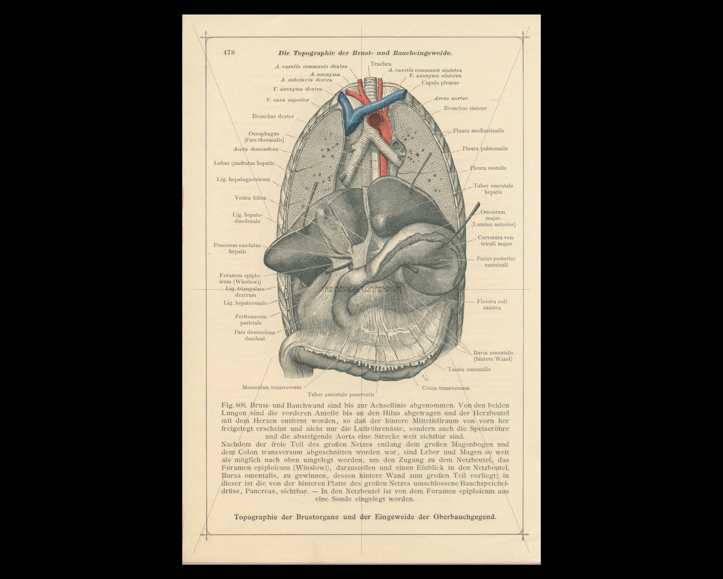 Antique Chest Anatomy Print Autopsy Rib Cage Thorax Chest Cavity  Cardiovascular System Human Anatomy 1911 - Etsy