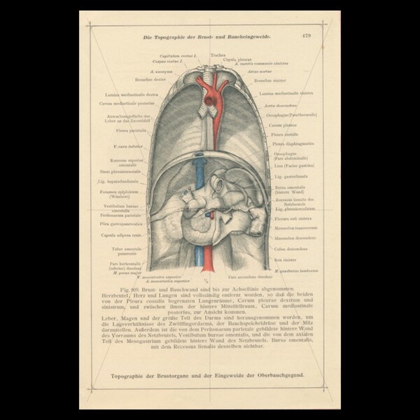 Antique Autopsy - Etsy