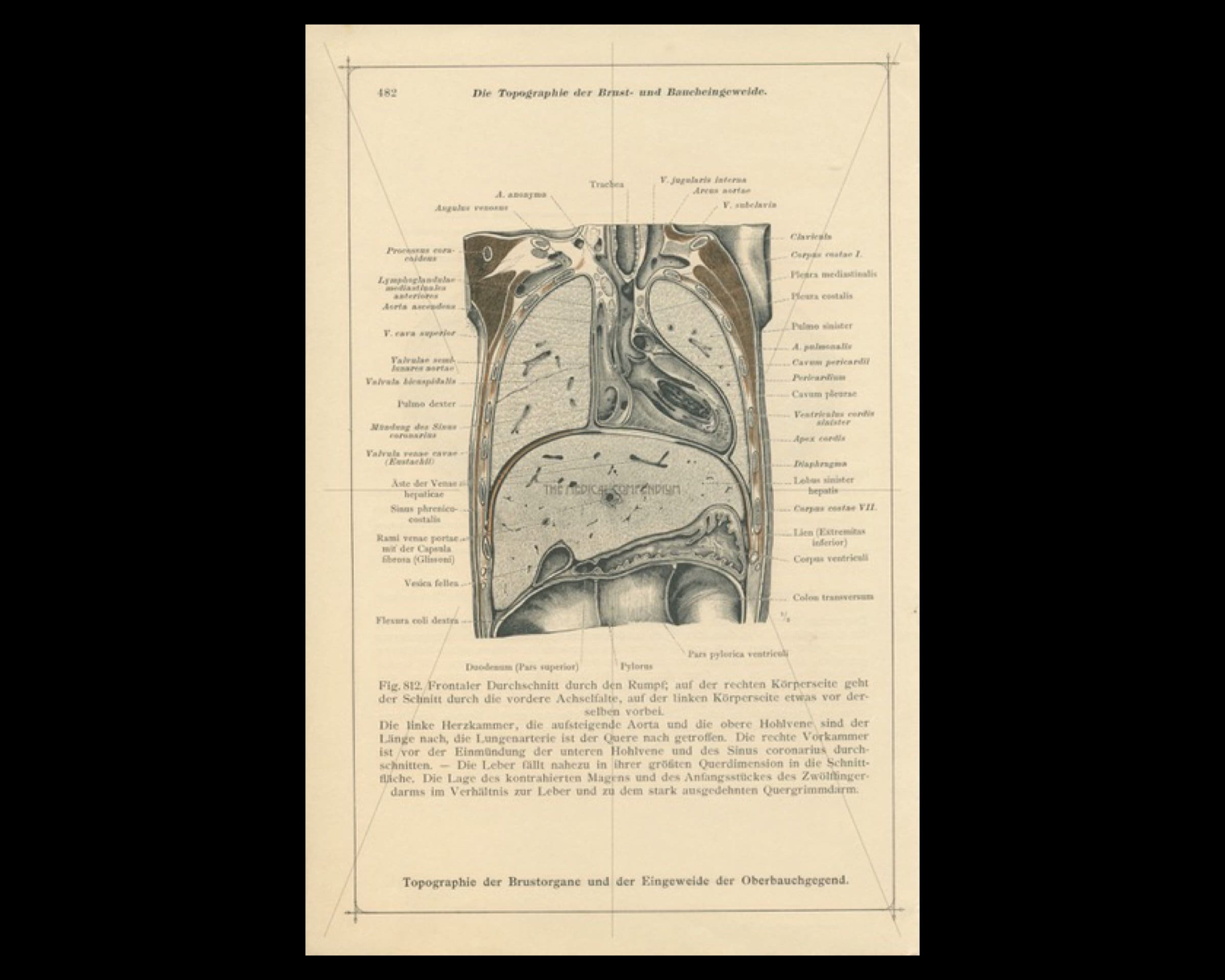 Antique Coronal Plane Anatomical Print Chest Anatomy Autopsy Abdominal Biology Diagrams