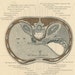 Antique Chest Anatomy Print Autopsy Rib Cage Chest Cavity Abdominal ...