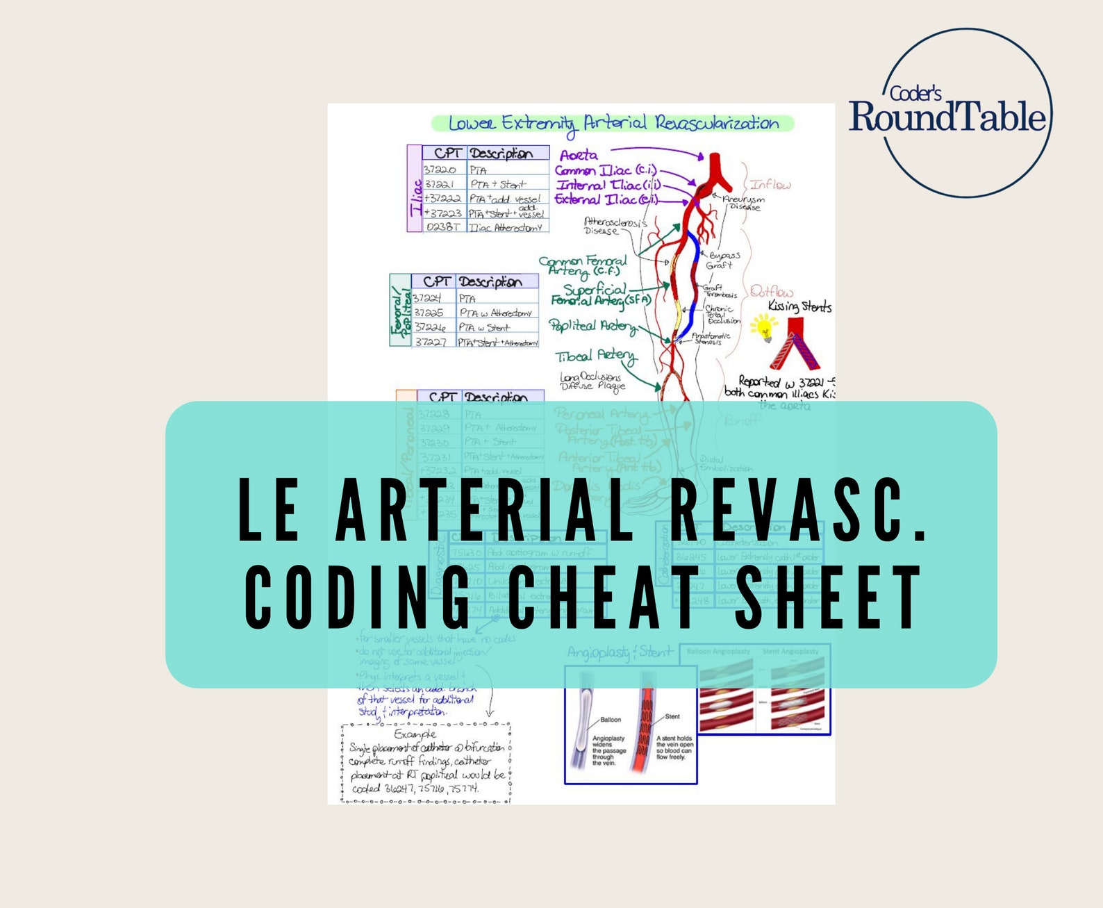 Lower Extremity Arterial Revascularization Coding Cheat Sheet Etsy