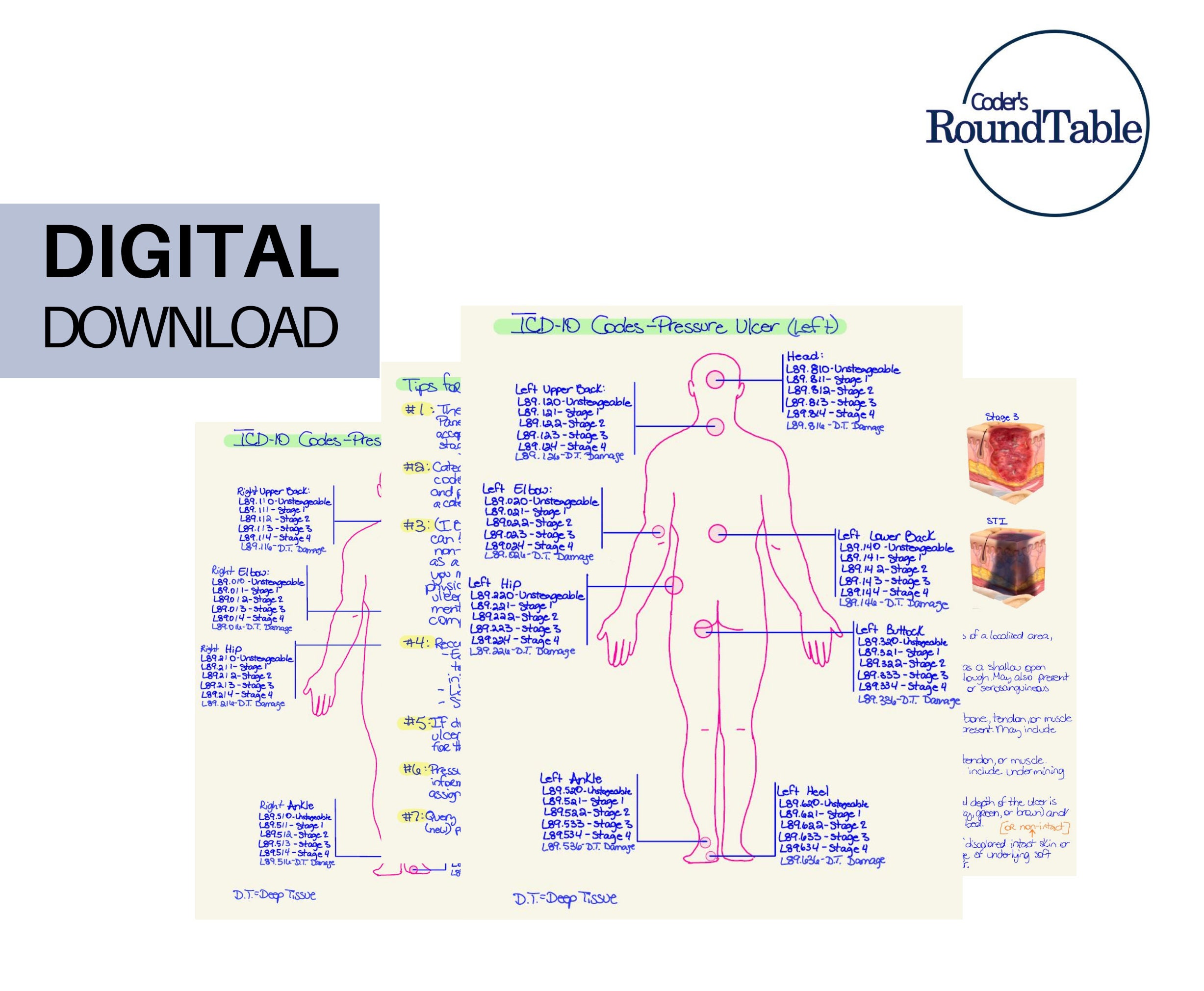 ICD-10-CM/PCS: Pressure Ulcers - YouTube