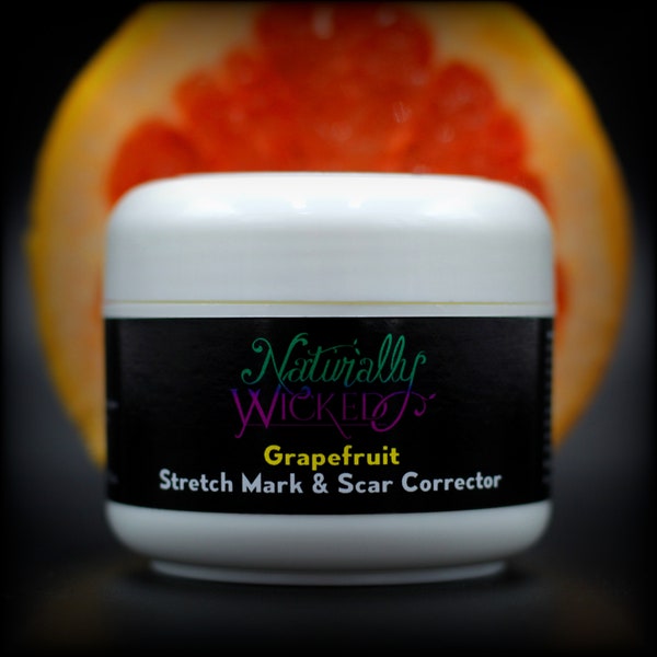 Naturally Wicked® Stretch Mark & Scar Corrector Cream | Prevents And Removes Stretchmarks Through Pregnancy: Natural, Cruelty Free and Vegan