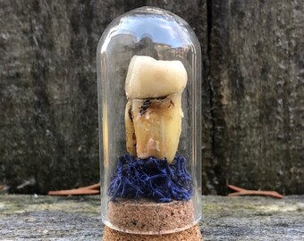 Human Tooth Bell Jar with Blue Moss