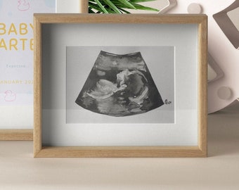 Hand-Painted Watercolour Sonogram Artwork - Cherish Your Baby's First Image |Baby Shower Gift|Ultrasound|Gender Reveal|Family Gift|Pregnancy