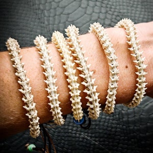 Pode incluir: Seis pulseiras feitas de segmentos semelhantes a ossos são enroladas em um braço. As pulseiras têm uma textura pontiaguda e são de cor esbranquiçada. O fundo é uma superfície escura e texturizada, possivelmente couro. Acessório único.