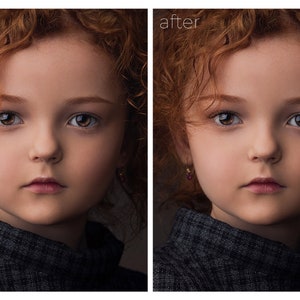 May include: Before and after photo of a young girl with red curly hair. The photo on the left shows the girl's natural skin tone, while the photo on the right shows her skin with a more even tone and less redness.