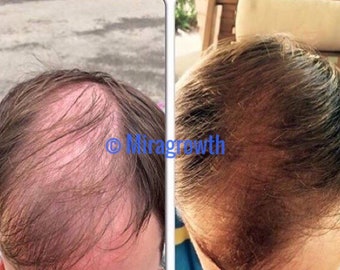 complément capillaire