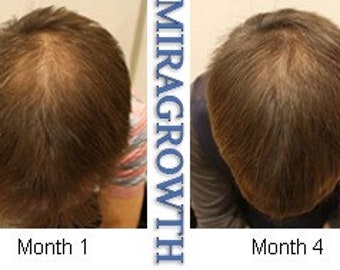 complément capillaire