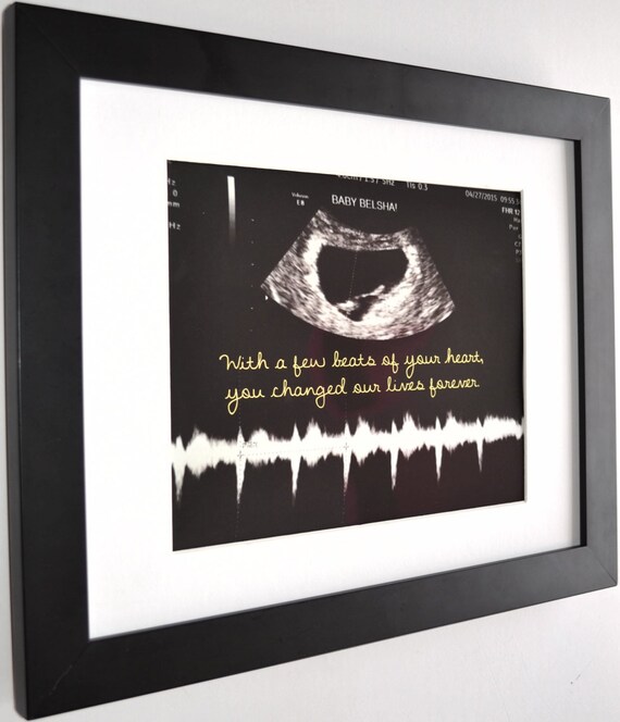 baby heartbeat sound