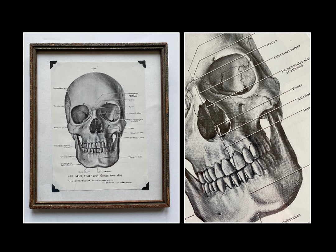 Framed Anatomical Skull Print, Front View (norma Frontalis