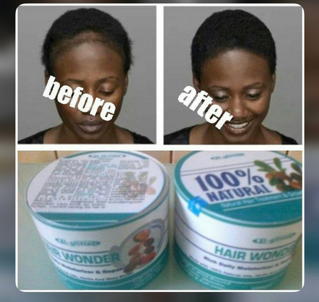 Hair Wonder Cream, Hair Loss Treatment, Natural Herbal Cream, Biggest