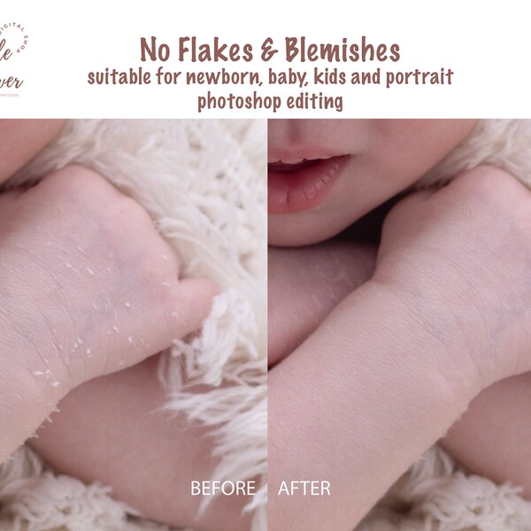 Pas de peau squameuse ni d'imperfections Action photographique pour nouveau-né pour bébé La photographie pour bébé élimine les imperfections Convient pour la retouche de la peau du nouveau-né