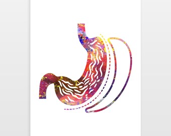 Gastric Sleeve Poster -  Stomach Organ Print - Watercolour print