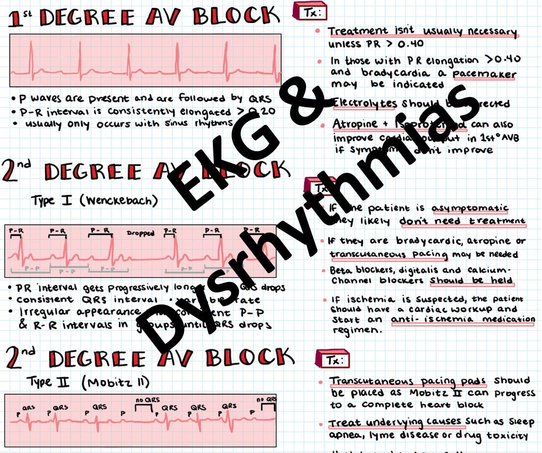 Ekg And Dysrhythmia Interpretation Basics For Nurses And Nursing Students
