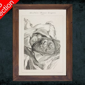 Human anatomy art print HUMAN DIGESTIVE SYSTEM anatomical antique sketch drawing