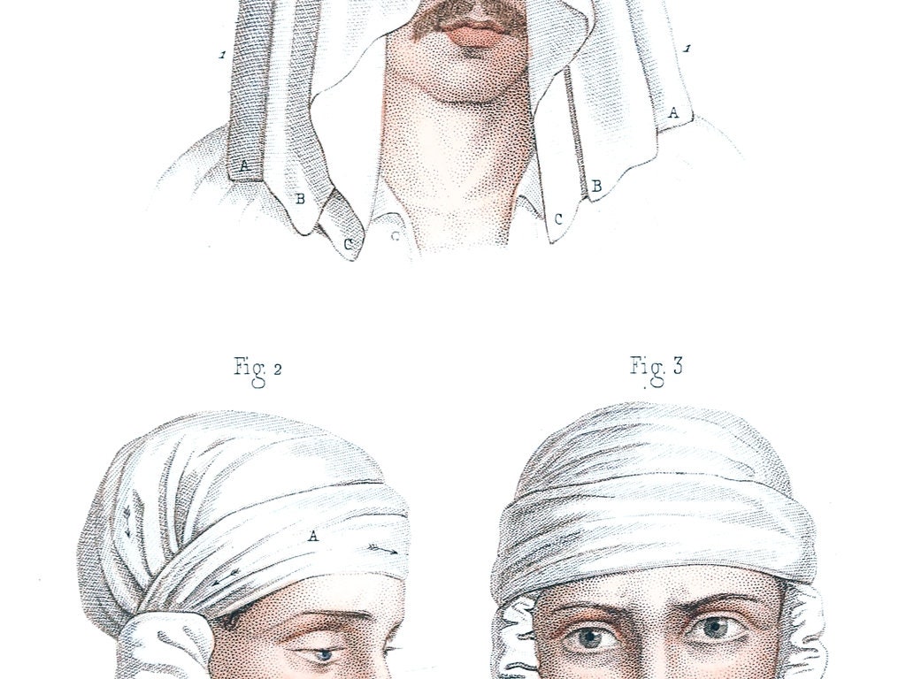 HEAD BANDAGE METHOD Anatomy Art Print for Medical Student Etsy UK