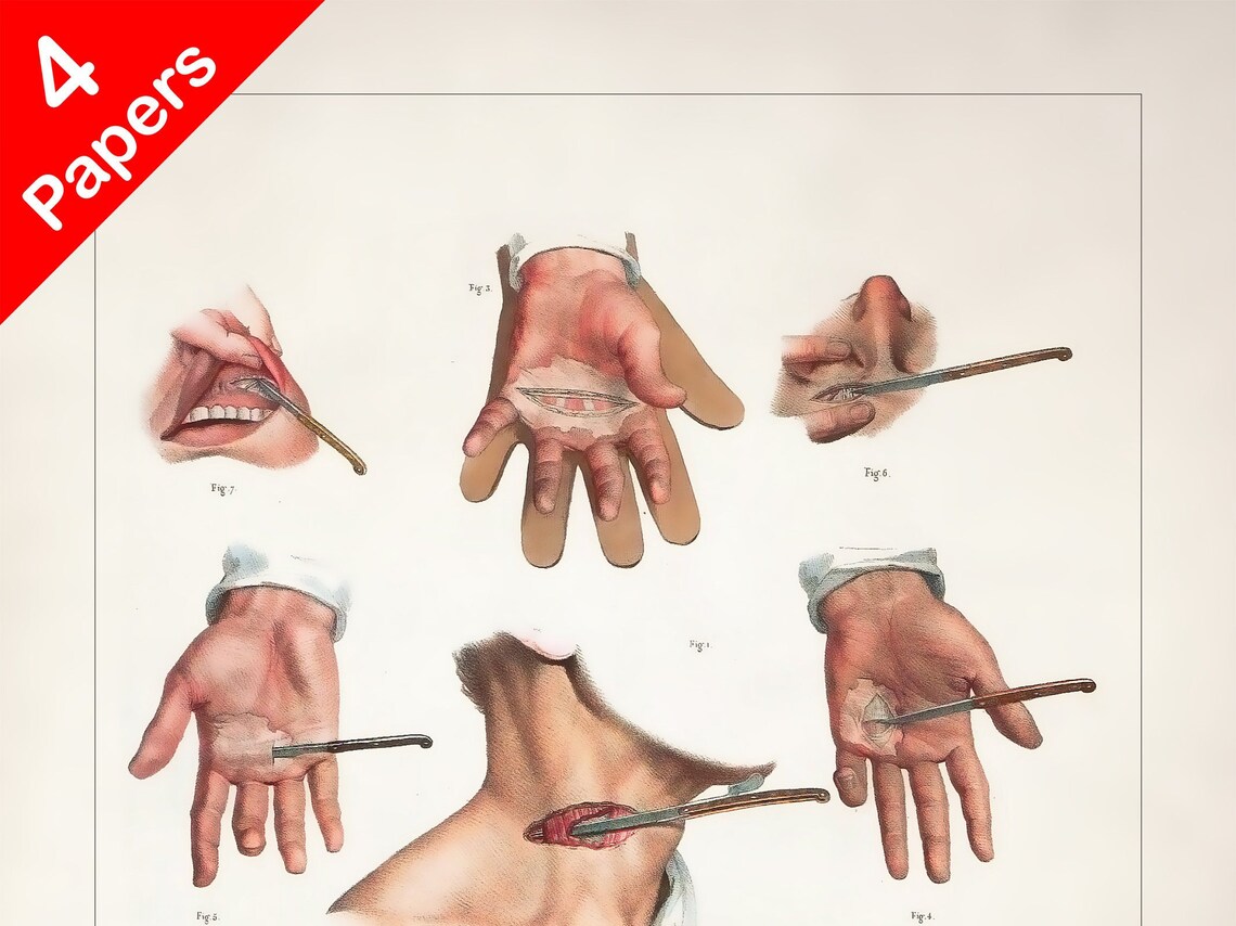 INCISION TECHNIQUE SCALPEL Anatomy Art Print for Medical Etsy