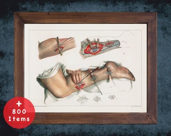 Tibia Artery Anatomy Art Print: Vintage Medical Decor