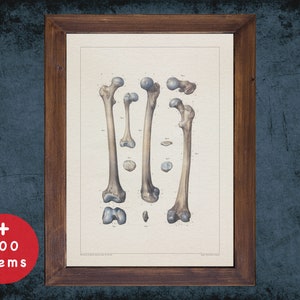 FEMUR THIGH BONE anatomy art print for medical student graduate, Radiologist and Radiology doctor gift office decor