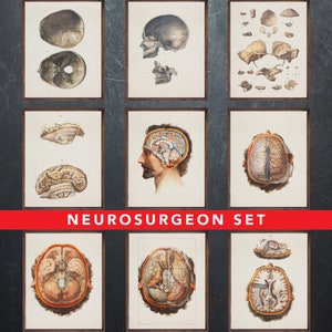 Anatomie afdrukken, set van 9 posters, als cadeau voor de neurochirurg arts, Neurochirurgie medische kantoor wanddecoratie kunst
