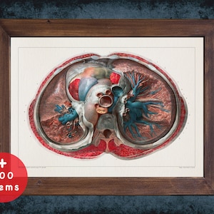 LUNG TOP ARTERY anatomy art print for medical student graduate, Pulmonologists and Pulmonology doctor gift office decor