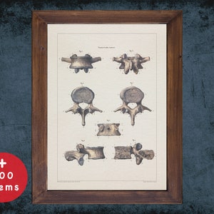 BACKBONE VERTEBRA INTERVERTEBRAL anatomy art print for medical student graduate, Radiologist and Radiology doctor gift office decor