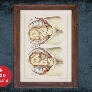 MIDWIFERY PREGNANCY GYNECOLOGY Anatomie Kunstdruck für Medizinstudent Absolvent, Hebamme und Geburtshilfe Arzt Geschenk Büro Dekor