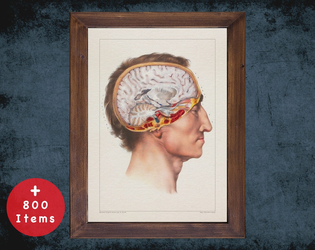BRAIN LATERAL VIEW Anatomy Art Print for Medical Student - Etsy Australia