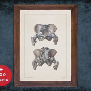 PELVIS FEMUR HEAD anatomy art print for medical student graduate, Radiologist and Radiology doctor gift office decor