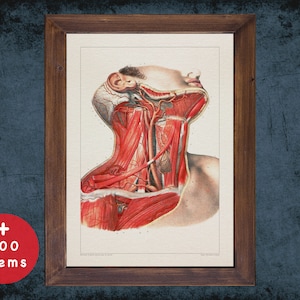 Op de afbeelding: Vintage anatomische illustratie van de menselijke nek, die de spieren en bloedvaten in detail laat zien. De afbeelding is in een ingelijst formaat en toont een gedetailleerde weergave van de anatomie.