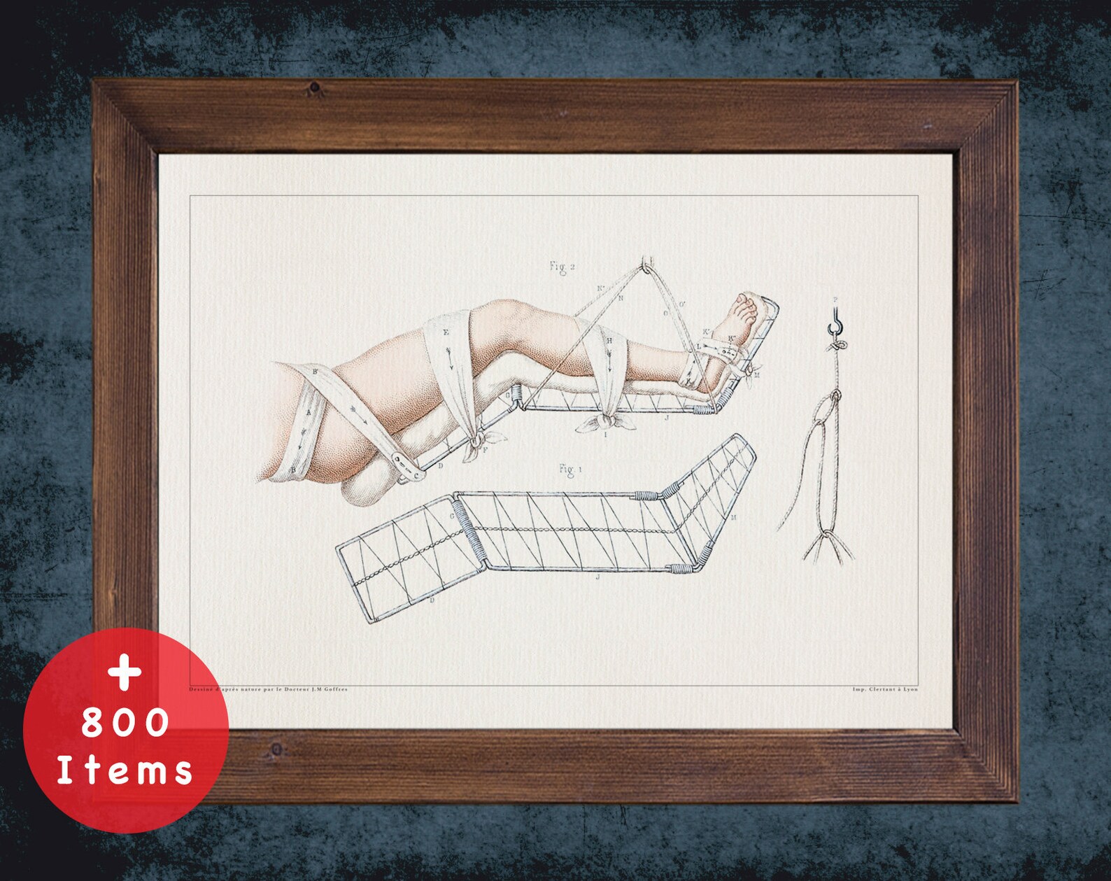 LEG SUSPENSION BANDAGE Anatomy Art Print for Medical Student Etsy