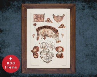 Mitral Valve Anatomy Art Print: Vintage French Medical Decor