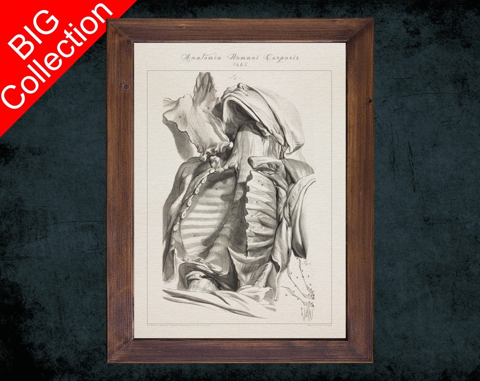 Anatomy Lymphatics Of Sternum Spermatic Cord Testicle Lower Extremity  Pelvis Intestine Victorian Anatomical Drawing High-Res Vector Graphic -  Getty Images