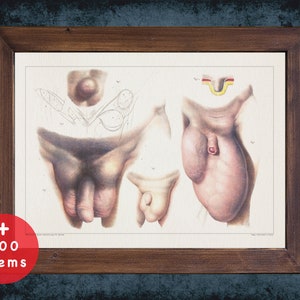 EXTERNAL HERNIA ASPECT anatomy art print for medical student gift, surgeon gift and surgery art doctor office decor