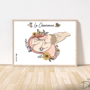 POSTER; POSTER; CAESAREAN SECTION / hospital, childbirth, surgery, birth, empowerment, c-section, cesarean, preparation, birth