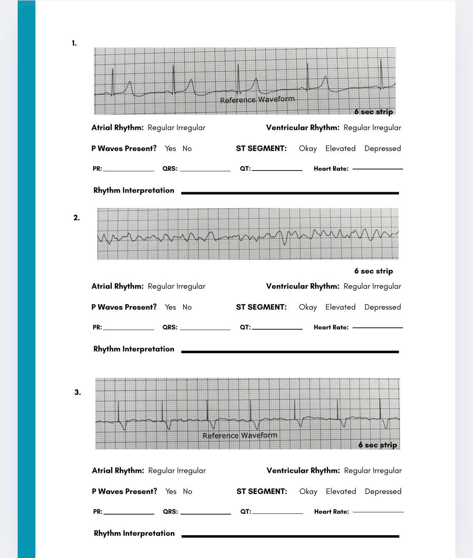 EKG Strip Interpretation Quiz | 9 Rhythm Practice Strips | Monitor Tech ...