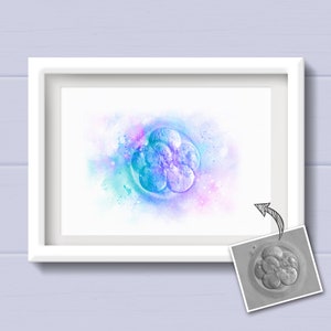 May include: A watercolour painting of a human embryo in a blue and purple colour scheme. The embryo is surrounded by a watercolour background with pink, blue, and green hues. A black and white photo of a human embryo is shown in the bottom right corner of the image.