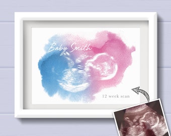 Baby shower gift. Gift for Mum to be from the bump. Pregnancy Keepsake from Bump. Personalised 4D Baby Scan Print. My first scan.