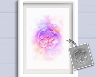 IVF embryo art print, Personalised Watercolour style nursery art decor. Custom IVF art print, Pregnancy gift, Baby shower gift.