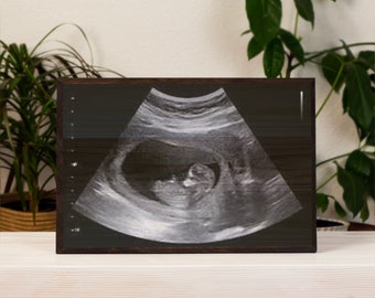 First Mothers Day Gift, Ultrasound Photo Gifts Ultrasound Printed on Wood Photo Gift for Mom First time Mom Gifts for Mom Photo Gifts Baby