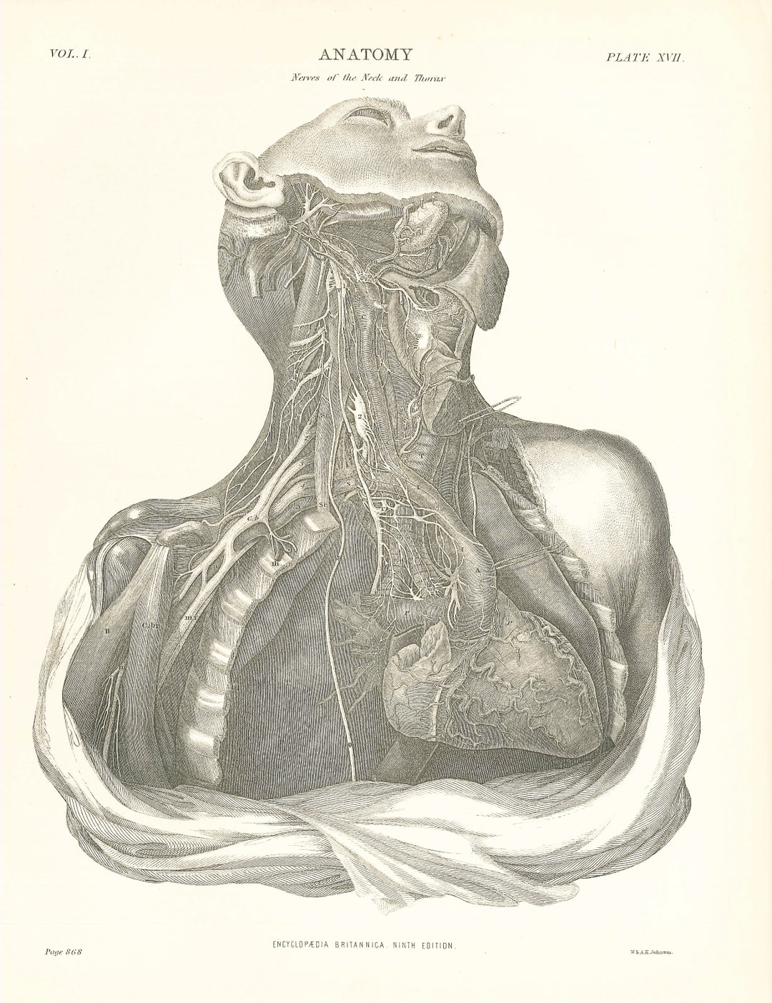 Antique ANATOMY NERVES of Neck & Thorax Rare Print 1870s Lithograph ...