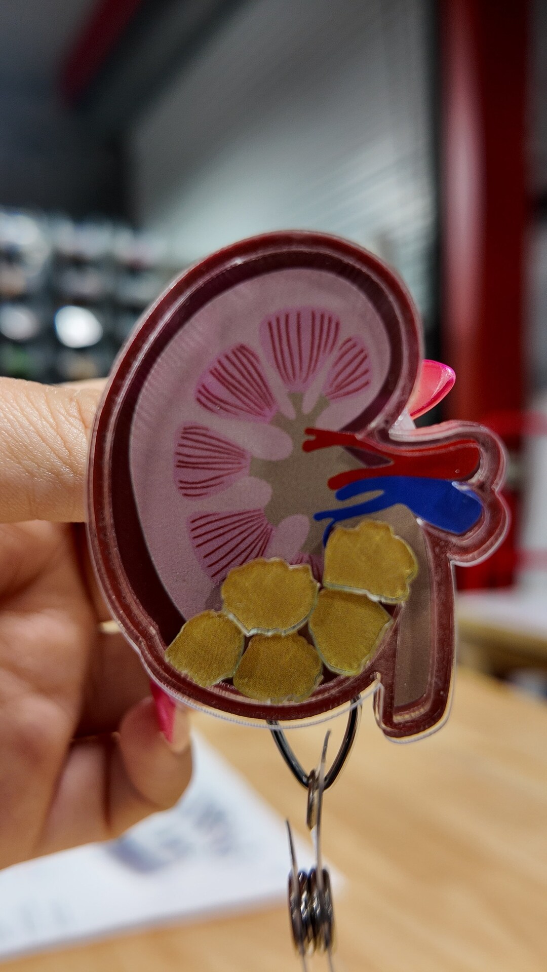 Kidney With Stones badge for Nurses Nurse Gifts Reel Etsy